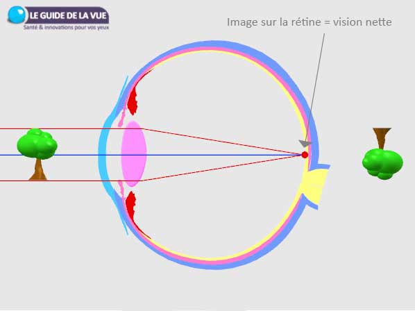 schéma axe optique 
