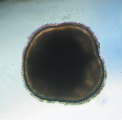 Organoïde de rétine obtenu à partir de cellules souches humaines © Institut de la Vision