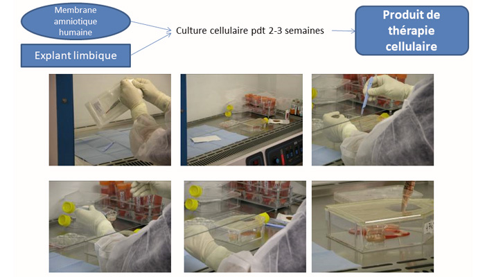 pathologies-cornee-partie-2-guide-vue