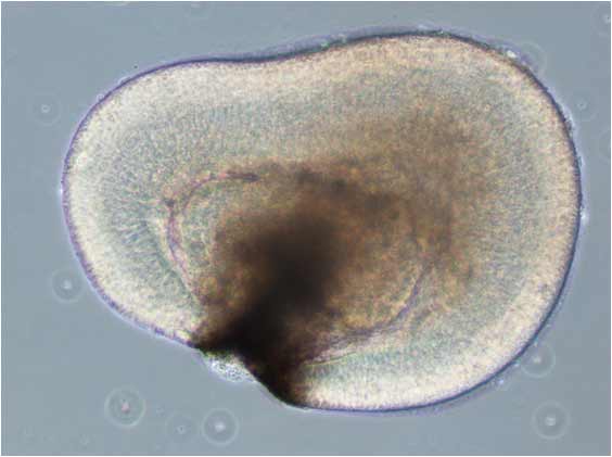 recherche maladie oeil thérapie cellulaire