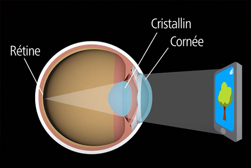 schéma de l'oeil