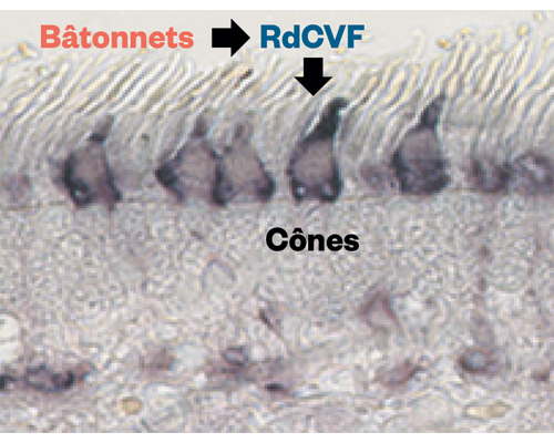 therapie-rdcvf-leveillard-institut-de-la-vision-guidevue