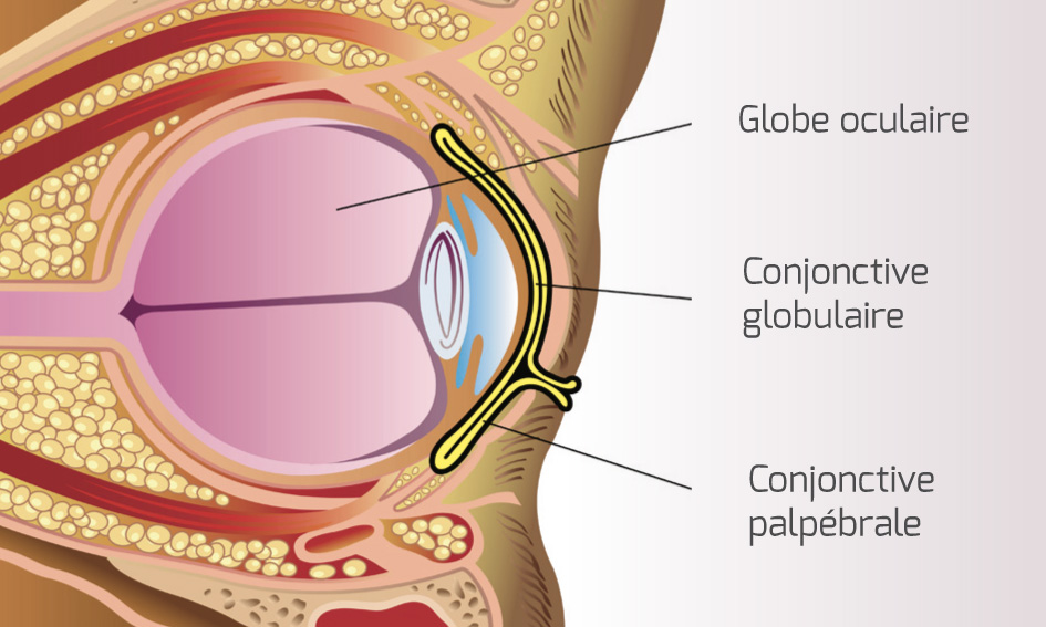 cancer paupière conjonctivite