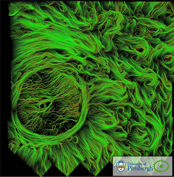 Vision Institute Pittsburgh