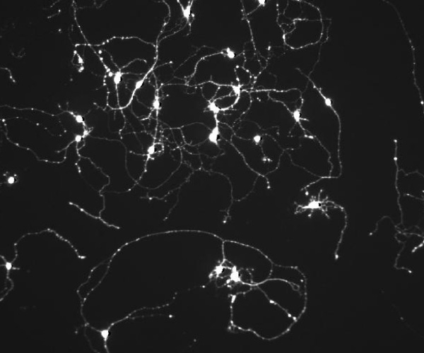  Cellules ganglionnaires marquées par la calcéine (marqueur de viabilité)