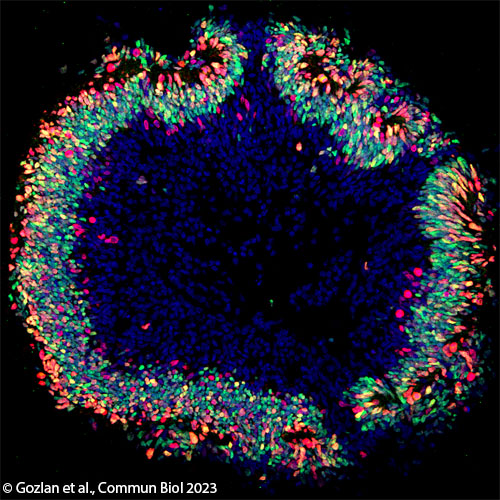 © Gozlan et al., Commun Biol 2023 