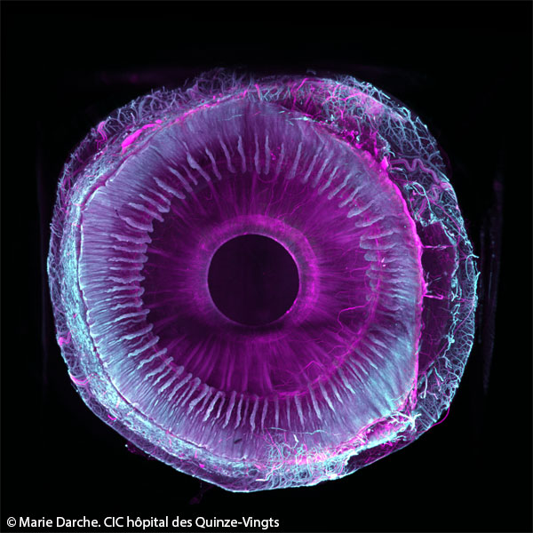 Segment-antérieur-de-l'oeil-Marie-Darche--Institut-de-la-Vision-Hopital-15-20-GuideVue-©-Marie-Darche-CIC-hopital-des-Quinze-Vingts