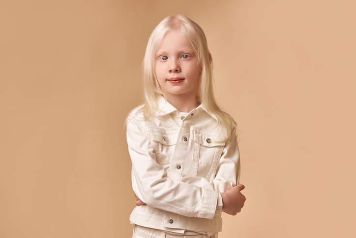 Albinisme oculaire - Comprendre l'albinisme des yeux