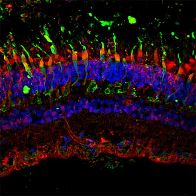 Marquage par immunofluorescence de la localisation de la protéine IDH3G (en rouge) dans les photorécepteurs (ici en vert) sur une coupe de rétine humaine. © Institut de la Vision